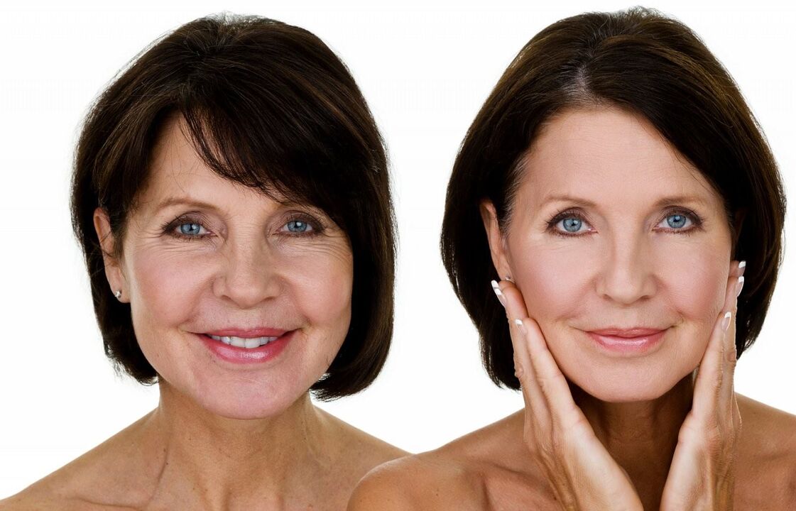 Rejuvenation nke anụ ahụ