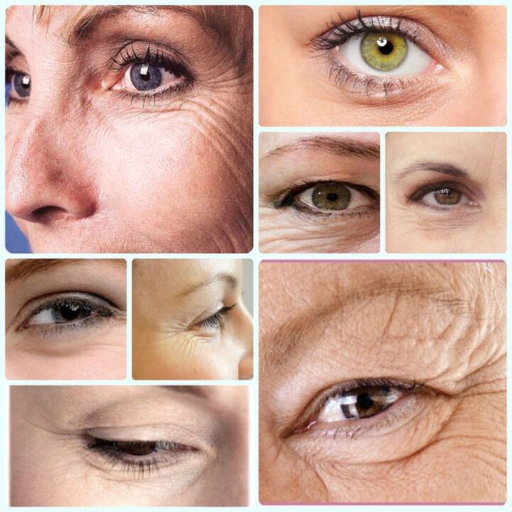 Rejuvenation nke anụahụ