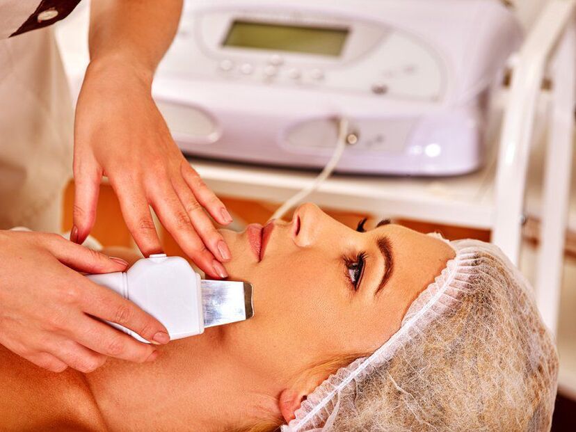 Ultrasonic ihu peeling