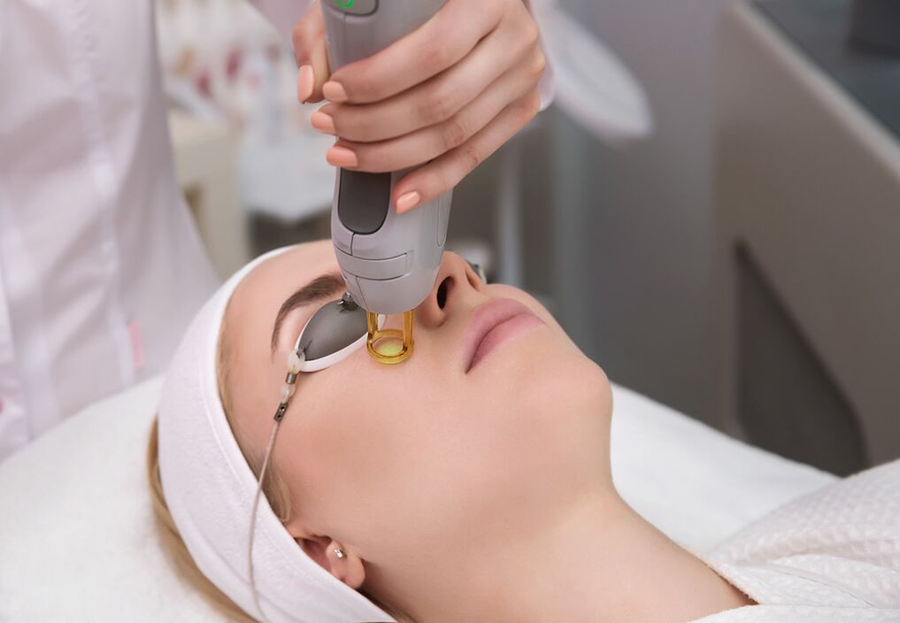 Kedu ka laser rejuvenation nke anụ ahụ gburugburu anya