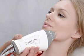 ihe kachasi mkpa nke usoro mmeghari akpụkpọ ahụ dị nkenke