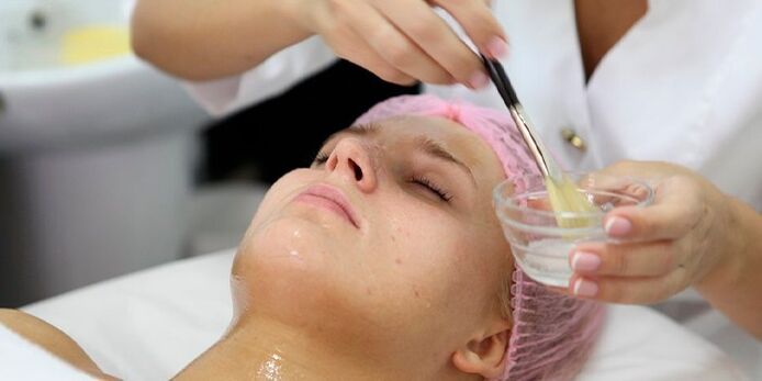 Nwanyị na-aga usoro peeling