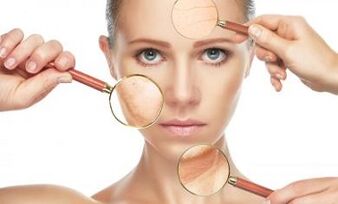 Kedu nsogbu akpụkpọ anụ nwere ike idozi rejuvenation akụkụ nke laser